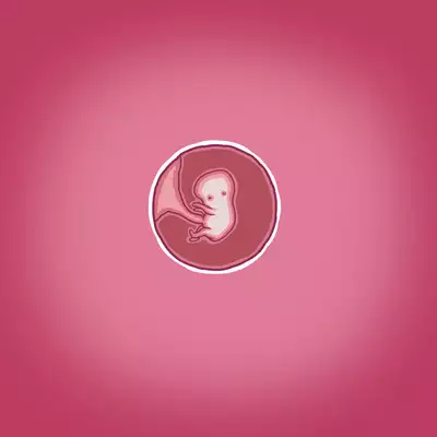 Yumi's Study Abroad/由美的留学生活（汉化）（连载中）